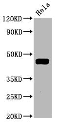 Western Blot
Positive WB detected in Hela whole cell lysate
All lanes Phospho-MAP2K1 antibody at 1.645μg/ml
Secondary
Goat polyclonal to rabbit IgG at 1/50000 dilution
Predicted band size: 45 KDa
Observed band size: 45 KDa