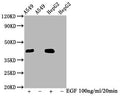 Western Blot
Positive WB detected in A549 whole cell lysate,HepG2 whole cell lysate(treated with EGF or not) 
All lanes Phospho-MAPK3 antibody at 2.35μg/ml
Secondary
Goat polyclonal to rabbit IgG at 1/50000 dilution
Predicted band size: 42 KDa
Observed band size: 42 KDa