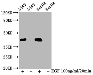 Western Blot
Positive WB detected in A549 whole cell lysate,HepG2 whole cell lysate(treated with EGF or not) 
All lanes Phospho-MAPK3 antibody at 2.35μg/ml
Secondary
Goat polyclonal to rabbit IgG at 1/50000 dilution
Predicted band size: 42 KDa
Observed band size: 42 KDa