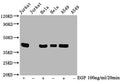 Western Blot
Positive WB detected in Jurkat whole cell lysate, Hela whole cell lysate, A549 whole cell lysate(treated with EGF or not) 
All lanes Phospho-MAPK3 antibody at 0.95μg/ml
Secondary
Goat polyclonal to rabbit IgG at 1/50000 dilution
Predicted band size: 42 KDa
Observed band size: 42 KDa