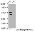 Western Blot
Positive WB detected in 293 whole cell lysate(treated with EGF or not) 
All lanes Phospho-MAPK8/MAPK9/MAPK10 antibody at 1.65μg/ml
Secondary
Goat polyclonal to rabbit IgG at 1/50000 dilution
Predicted band size: 46,54 KDa
Observed band size: 46,54 KDa