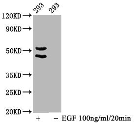 Western Blot
Positive WB detected in 293 whole cell lysate(treated with EGF or not) 
All lanes Phospho-MAPK8/MAPK9/MAPK10 antibody at 1.65μg/ml
Secondary
Goat polyclonal to rabbit IgG at 1/50000 dilution
Predicted band size: 46,54 KDa
Observed band size: 46,54 KDa