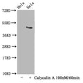 Western Blot
Positive WB detected in Hela whole cell lysate(treated with Calyculin A or not) 
All lanes Phospho-MAPT antibody at 1.63μg/ml
Secondary
Goat polyclonal to rabbit IgG at 1/50000 dilution
Predicted band size: 46 KDa
Observed band size: 46 KDa