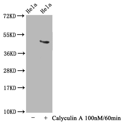 Western Blot
Positive WB detected in Hela whole cell lysate(treated with Calyculin A or not) 
All lanes Phospho-MAPT antibody at 1.63μg/ml
Secondary
Goat polyclonal to rabbit IgG at 1/50000 dilution
Predicted band size: 46 KDa
Observed band size: 46 KDa