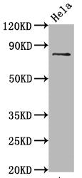 Phospho-MAPT (S396) Antibody – Figure 1 of 1