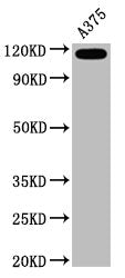 Western Blot
Positive WB detected in A375 whole cell lysate
All lanes CD146 antibody at 0.6μg/ml
Secondary
Goat polyclonal to rabbit IgG at 1/50000 dilution
Predicted band size: 72 KDa
Observed band size: 120 KDa
