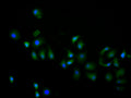 Immunofluorescence staining of hela cell with CSB-RA013826MA1HU at 1:60, counter-stained with DAPI. The cells were fixed in 4% formaldehyde and blocked in 10% normal Goat Serum. The cells were then incubated with the antibody overnight at 4C. The secondary antibody was FITC-conjugated AffiniPure Goat Anti-Human IgG(H+L) .