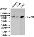 Western Blot
Positive WB detected in: HEK293 whole cell lysate(30µg), A549 whole cell lysate(30µg), U251 whole cell lysate(30µg)
All lanes: MCM antibody at 1:1000
Secondary
Goat polyclonal to rabbit IgG at 1/40000 dilution
Predicted band size: 83 kDa
Observed band size: 83 kDa
Exposure time：2min