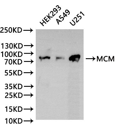 Western Blot
Positive WB detected in: HEK293 whole cell lysate(30µg), A549 whole cell lysate(30µg), U251 whole cell lysate(30µg)
All lanes: MCM antibody at 1:1000
Secondary
Goat polyclonal to rabbit IgG at 1/40000 dilution
Predicted band size: 83 kDa
Observed band size: 83 kDa
Exposure time：2min
