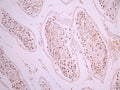 IHC image of CSB-RA014345A0HU diluted at 1:100 and staining in paraffin-embedded human testis tissue performed on a Leica BondTM system. After dewaxing and hydration, antigen retrieval was mediated by high pressure in a citrate buffer (pH 6.0). Section was blocked with 10% normal goat serum 30min at RT. Then primary antibody (1% BSA) was incubated at 4°C overnight. The primary is detected by a Goat anti-rabbit polymer IgG labeled by HRP and visualized using 0.05% DAB.