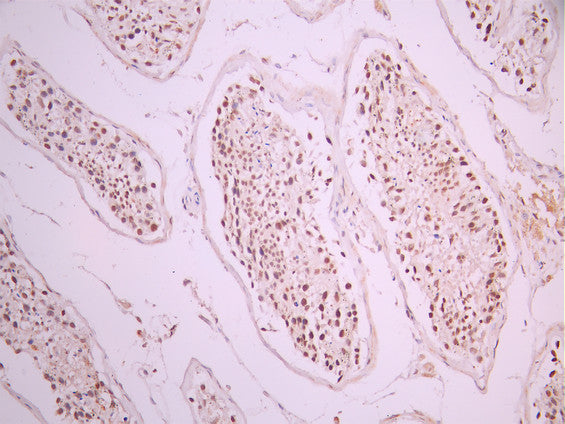 IHC image of CSB-RA014345A0HU diluted at 1:100 and staining in paraffin-embedded human testis tissue performed on a Leica BondTM system. After dewaxing and hydration, antigen retrieval was mediated by high pressure in a citrate buffer (pH 6.0). Section was blocked with 10% normal goat serum 30min at RT. Then primary antibody (1% BSA) was incubated at 4°C overnight. The primary is detected by a Goat anti-rabbit polymer IgG labeled by HRP and visualized using 0.05% DAB.