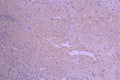 IHC image of CSB-RA014666MA1HU diluted at 1：50 and staining in paraffin-embedded human placenta tissue performed on a Leica BondTM system. After dewaxing and hydration, antigen retrieval was mediated by high pressure in a citrate buffer (pH 6.0) . Section was blocked with 10% normal goat serum 30min at RT. Then primary antibody (1% BSA) was incubated at 4°C overnight. The primary is detected by a Anti-Human lgG, Fcy Fragment Specific labeled by HRP and visualized using 0.05% DAB.