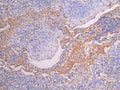 IHC image of CSB-RA014679MA1HU diluted at 1:150 and staining in paraffin-embedded human tonsil tissue performed on a Leica BondTM system. After dewaxing and hydration, antigen retrieval was mediated by high pressure in a citrate buffer (pH 6.0) . Section was blocked with 10% normal goat serum 30min at RT. Then primary antibody (1% BSA) was incubated at 4°C overnight. The primary is detected by a Goat anti-human polymer IgG labeled by HRP and visualized using 0.05% DAB.