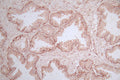 IHC image of CSB-RA014781MA1HU diluted at 1:600 and staining in paraffin-embedded human prostate tissue performed on a Leica BondTM system. After dewaxing and hydration, antigen retrieval was mediated by high pressure in a citrate buffer (pH 6.0) . Section was blocked with 10% normal goat serum 30min at RT. Then primary antibody (1% BSA) was incubated at 4°C overnight. The primary is detected by a Goat anti-Mouse IgG labeled by HRP and visualized using 0.05% DAB.