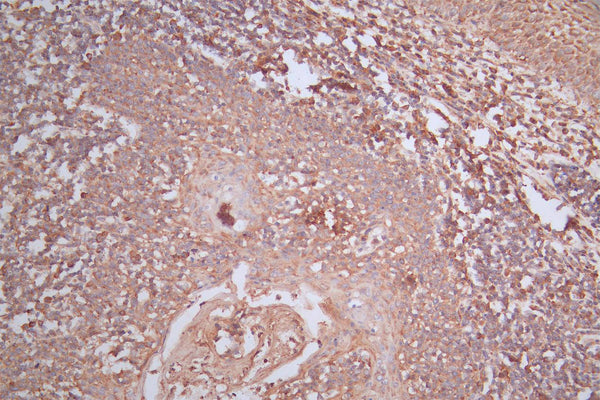 IHC image of CSB-RA015007MA4HU diluted at 1:200 and staining in paraffin-embedded human tonsil tissue performed on a Leica BondTM system. After dewaxing and hydration, antigen retrieval was mediated by high pressure in a citrate buffer (pH 6.0) . Section was blocked with 10% normal goat serum 30min at RT. Then primary antibody (1% BSA) was incubated at 4°C overnight. The primary is detected by a Goat anti-Mouse IgG labeled by HRP and visualized using 0.05% DAB.