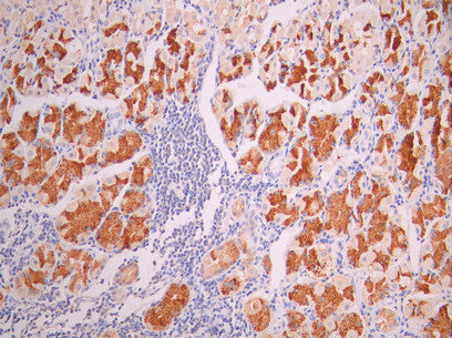 IHC image of CSB-RA015215MA1HU diluted at 1:50 and staining in paraffin-embedded human stomach tissue performed on a Leica BondTM system. After dewaxing and hydration, antigen retrieval was mediated by high pressure in a citrate buffer (pH 6.0). Section was blocked with 10% normal goat serum 30min at RT. Then primary antibody (1% BSA) was incubated at 4°C overnight. The primary is detected by a Goat anti-mouse polymer IgG labeled by HRP and visualized using 0.05% DAB.