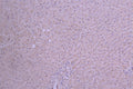 IHC image of CSB-RA015243MA1HU diluted at 1：50 and staining in paraffin-embedded human liver tissue performed on a Leica BondTM system. After dewaxing and hydration, antigen retrieval was mediated by high pressure in a citrate buffer (pH 6.0) . Section was blocked with 10% normal goat serum 30min at RT. Then primary antibody (1% BSA) was incubated at 4°C overnight. The primary is detected by a Goat anti-human polymer IgG labeled by HRP and visualized using 0.05% DAB.