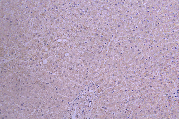 IHC image of CSB-RA015243MA1HU diluted at 1：50 and staining in paraffin-embedded human liver tissue performed on a Leica BondTM system. After dewaxing and hydration, antigen retrieval was mediated by high pressure in a citrate buffer (pH 6.0) . Section was blocked with 10% normal goat serum 30min at RT. Then primary antibody (1% BSA) was incubated at 4°C overnight. The primary is detected by a Goat anti-human polymer IgG labeled by HRP and visualized using 0.05% DAB.