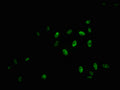 Immunofluorescence staining of Hela cells with CSB-RA015261A11phHU at 1:100,counter-stained with DAPI. The cells were fixed in 4% formaldehyde, permeabilized using 0.2% Triton X-100 and blocked in 10% normal Goat Serum. The cells were then incubated with the antibody overnight at 4℃. The secondary antibody was Alexa Fluor 488-congugated AffiniPure Goat Anti-Rabbit IgG (H+L) .