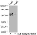 Western Blot
Positive WB detected in HepG2 whole cell lysate(treated with EGF or not) 
All lanes Phospho-MYC antibody at 0.99μg/ml
Secondary
Goat polyclonal to rabbit IgG at 1/50000 dilution
Predicted band size: 57 KDa
Observed band size: 57 KDa