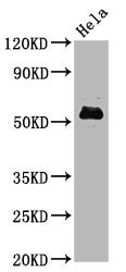 Western Blot
Positive WB detected in Hela whole cell lysate
All lanes Phospho-MYC antibody at 1.4μg/ml
Secondary
Goat polyclonal to rabbit IgG at 1/50000 dilution
Predicted band size: 57 KDa
Observed band size: 57 KDa