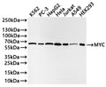 Western Blot
Positive WB detected in: K562 whole cell lysate(20µg) , PC-3 whole cell lysate(20µg) , HepG2 whole cell lysate(20µg) , HeLa whole cell lysate(20µg) , Jurkat whole cell lysate(20µg) , A549 whole cell lysate(20µg) , HEK293 whole cell lysate(20µg) 
All lanes: MYC antibody at 1:1000
Secondary
Goat polyclonal to rabbit IgG at 1/40000 dilution
Predicted band size: 51 kDa
Observed band size: 56 kDa
Exposure time：30s