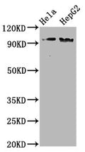 Western Blot
Positive WB detected in Hela whole cell lysate,HepG2 whole cell lysate
All lanes Phospho-NBN antibody at 1.98μg/ml
Secondary
Goat polyclonal to rabbit IgG at 1/50000 dilution
Predicted band size: 95 KDa
Observed band size: 95 KDa