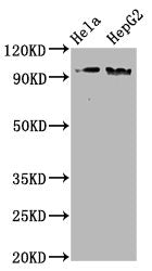 Western Blot
Positive WB detected in Hela whole cell lysate,HepG2 whole cell lysate
All lanes Phospho-NBN antibody at 1.98μg/ml
Secondary
Goat polyclonal to rabbit IgG at 1/50000 dilution
Predicted band size: 95 KDa
Observed band size: 95 KDa