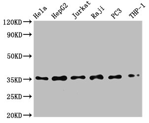 Western Blot
Positive WB detected in: Hela whole cell lysate, HepG2 whole cell lysate, Jurkat whole cell lysate, Raji whole cell lysate, PC3 whole cell lysate, THP-1 whole cell lysate
All lanes: NFKBIA antibody at 0.79μg/ml
Secondary
Goat polyclonal to rabbit IgG at 1/50000 dilution
Predicted band size: 36 KDa
Observed band size: 36 KDa