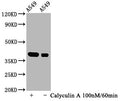 Western Blot
Positive WB detected in A549 whole cell lysate(treated with Calyculin A or not) 
All lanes Phospho-NFKBIA antibody at 1.07μg/ml
Secondary
Goat polyclonal to rabbit IgG at 1/50000 dilution
Predicted band size: 39 KDa
Observed band size: 39 KDa