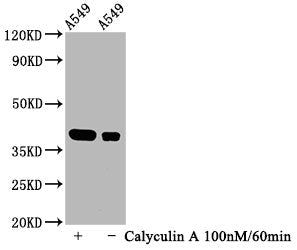 Western Blot
Positive WB detected in A549 whole cell lysate(treated with Calyculin A or not) 
All lanes Phospho-NFKBIA antibody at 1.07μg/ml
Secondary
Goat polyclonal to rabbit IgG at 1/50000 dilution
Predicted band size: 39 KDa
Observed band size: 39 KDa