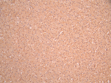 IHC image of CSB-RA016133MA1HU diluted at 1:50 and staining in paraffin-embedded human kidney tissue上腺 performed on a Leica BondTM system. After dewaxing and hydration, antigen retrieval was mediated by high pressure in a citrate buffer (pH 6.0). Section was blocked with 10% normal goat serum 30min at RT. Then primary antibody (1% BSA) was incubated at 4°C overnight. The primary is detected by a Anti-Human lgG, Fcy Fragment Specific labeled by HRP and visualized using 0.05% DAB.