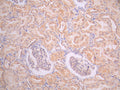 IHC image of CSB-RA016426A0MO diluted at 1:100 and staining in paraffin-embedded human kidney tissue performed on a Leica BondTM system. After dewaxing and hydration, antigen retrieval was mediated by high pressure in a citrate buffer (pH 6.0). Section was blocked with 10% normal goat serum 30min at RT. Then primary antibody (1% BSA) was incubated at 4°C overnight. The primary is detected by a Goat anti-rabbit polymer IgG labeled by HRP and visualized using 0.05% DAB.