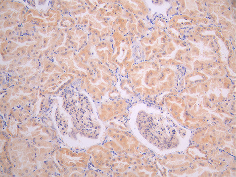 IHC image of CSB-RA016426A0MO diluted at 1:100 and staining in paraffin-embedded human kidney tissue performed on a Leica BondTM system. After dewaxing and hydration, antigen retrieval was mediated by high pressure in a citrate buffer (pH 6.0). Section was blocked with 10% normal goat serum 30min at RT. Then primary antibody (1% BSA) was incubated at 4°C overnight. The primary is detected by a Goat anti-rabbit polymer IgG labeled by HRP and visualized using 0.05% DAB.