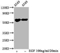 Western Blot
Positive WB detected in A549 whole cell lysate(treated with EGF or not) 
All lanes Phospho-PAK1/PAK2/PAK3 antibody at 1.2μg/ml
Secondary
Goat polyclonal to rabbit IgG at 1/50000 dilution
Predicted band size: 65 KDa
Observed band size: 65 KDa