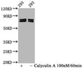 Western Blot
Positive WB detected in 293 whole cell lysate(treated with Calyculin A or not) 
All lanes Phospho-PAK4/PAK5/PAK6 antibody at 2.15μg/ml
Secondary
Goat polyclonal to rabbit IgG at 1/50000 dilution
Predicted band size: 64,75,80 KDa
Observed band size: 75,80 KDa