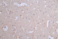 IHC image of CSB-RA017450A0HU diluted at 1:50 and staining in paraffin-embedded human brain tissue performed on a Leica BondTM system. After dewaxing and hydration, antigen retrieval was mediated by high pressure in a citrate buffer (pH 6.0) . Section was blocked with 10% normal goat serum 30min at RT. Then primary antibody (1% BSA) was incubated at 4°C overnight. The primary is detected by a Goat anti-rabbit polymer IgG labeled by HRP and visualized using 0.62% DAB.