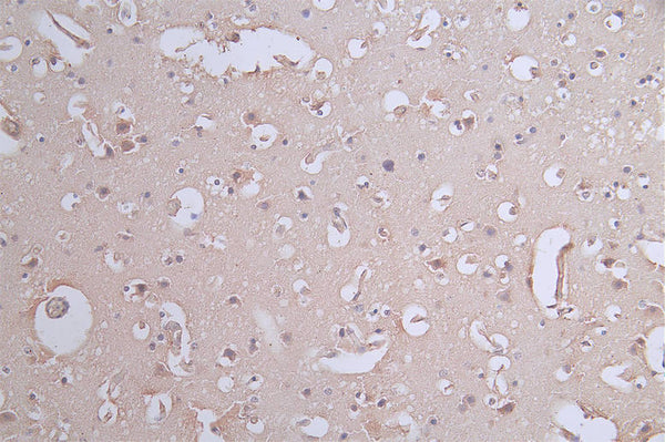IHC image of CSB-RA017450A0HU diluted at 1:50 and staining in paraffin-embedded human brain tissue performed on a Leica BondTM system. After dewaxing and hydration, antigen retrieval was mediated by high pressure in a citrate buffer (pH 6.0) . Section was blocked with 10% normal goat serum 30min at RT. Then primary antibody (1% BSA) was incubated at 4°C overnight. The primary is detected by a Goat anti-rabbit polymer IgG labeled by HRP and visualized using 0.62% DAB.