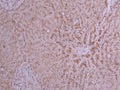 IHC image of CSB-RA017647MA1HU diluted at 1:200 and staining in paraffin-embedded human liver performed on a Leica BondTM system. After dewaxing and hydration, antigen retrieval was mediated by high pressure in a citrate buffer (pH 6.0) . Section was blocked with 10% normal goat serum 30min at RT. Then primary antibody (1% BSA) was incubated at 4°C overnight. The primary is detected by a Goat anti-mouse polymer IgG labeled by HRP and visualized using 0.05% DAB.