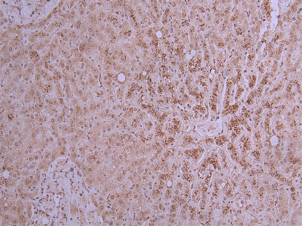 IHC image of CSB-RA017647MA1HU diluted at 1:200 and staining in paraffin-embedded human liver performed on a Leica BondTM system. After dewaxing and hydration, antigen retrieval was mediated by high pressure in a citrate buffer (pH 6.0) . Section was blocked with 10% normal goat serum 30min at RT. Then primary antibody (1% BSA) was incubated at 4°C overnight. The primary is detected by a Goat anti-mouse polymer IgG labeled by HRP and visualized using 0.05% DAB.