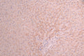 IHC image of CSB-RA017647MA3HU diluted at 1:50 and staining in paraffin-embedded human liver tissue performed on a Leica BondTM system. After dewaxing and hydration, antigen retrieval was mediated by high pressure in a citrate buffer (pH 6.0) . Section was blocked with 10% normal goat serum 30min at RT. Then primary antibody (1% BSA) was incubated at 4°C overnight. The primary is detected by a Anti-Human lgG, Fcy Fragment Specific labeled by HRP and visualized using 0.05% DAB.