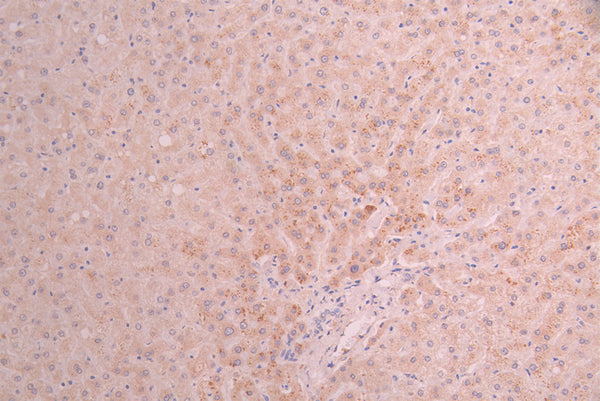 IHC image of CSB-RA017647MA3HU diluted at 1:50 and staining in paraffin-embedded human liver tissue performed on a Leica BondTM system. After dewaxing and hydration, antigen retrieval was mediated by high pressure in a citrate buffer (pH 6.0) . Section was blocked with 10% normal goat serum 30min at RT. Then primary antibody (1% BSA) was incubated at 4°C overnight. The primary is detected by a Anti-Human lgG, Fcy Fragment Specific labeled by HRP and visualized using 0.05% DAB.