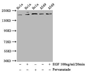 Western Blot
Positive WB detected in Hela whole cell lysate,A549 whole cell lysate(treated with EGF or Pervanadate) 
All lanes Phospho-PDGFRB antibody at 1.14μg/ml
Secondary
Goat polyclonal to rabbit IgG at 1/50000 dilution
Predicted band size: 190 KDa
Observed band size: 190 KDa
