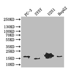 Western Blot
Positive WB detected in: PC-3 whole cell lysate, SY5Y whole cell lysate, U251 whole cell lysate, HepG2 whole cell lysate
All lanes: PDPN antibody at 1:1000
Secondary
Goat polyclonal to mouse IgG at 1/50000 dilution
Predicted band size: 17 kDa
Observed band size: 17 kDa