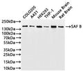 Western Blot
Positive WB detected in: COLO-205 whole cell lysate(30µg), A-431 whole cell lysate(30µg), HEK293 whole cell lysate(30µg), THP-1 whole cell lysate(30µg), Mouse brain tissue lysate(30µg), Rat brain tissue lysate(30µg)
All lanes: SAF B antibody at 1:1000
Secondary
Goat polyclonal to rabbit IgG at 1/40000 dilution
Predicted band size: 103 kDa
Observed band size: 150 kDa
Exposure time：1min