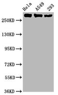 Western Blot
Positive WB detected in Hela whole cell lysate,A549 whole cell lysate,293 whole cell lysate
All lanes Phospho-POLR2A antibody at 1.02μg/ml
Secondary
Goat polyclonal to rabbit IgG at 1/50000 dilution
Predicted band size: 270 KDa
Observed band size: 270 KDa