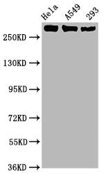 Western Blot
Positive WB detected in Hela whole cell lysate,A549 whole cell lysate,293 whole cell lysate
All lanes Phospho-POLR2A antibody at 1.02μg/ml
Secondary
Goat polyclonal to rabbit IgG at 1/50000 dilution
Predicted band size: 270 KDa
Observed band size: 270 KDa