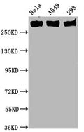 Western Blot
Positive WB detected in Hela whole cell lysate,A549 whole cell lysate,293 whole cell lysate
All lanes Phospho-POLR2A antibody at 0.75μg/ml
Secondary
Goat polyclonal to rabbit IgG at 1/50000 dilution
Predicted band size: 270 KDa
Observed band size: 270 KDa