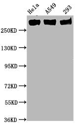 Western Blot
Positive WB detected in Hela whole cell lysate,A549 whole cell lysate,293 whole cell lysate
All lanes Phospho-POLR2A antibody at 0.75μg/ml
Secondary
Goat polyclonal to rabbit IgG at 1/50000 dilution
Predicted band size: 270 KDa
Observed band size: 270 KDa