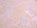 IHC image of CSB-RA018403MA1HU diluted at 1:50 and staining in paraffin-embedded human kidney tissue performed on a Leica BondTM system. After dewaxing and hydration, antigen retrieval was mediated by high pressure in a citrate buffer (pH 6.0). Section was blocked with 10% normal goat serum 30min at RT. Then primary antibody (1% BSA) was incubated at 4°C overnight. The primary is detected by a Anti-Human lgG, Fcy Fragment Specific labeled by HRP and visualized using 0.05% DAB.